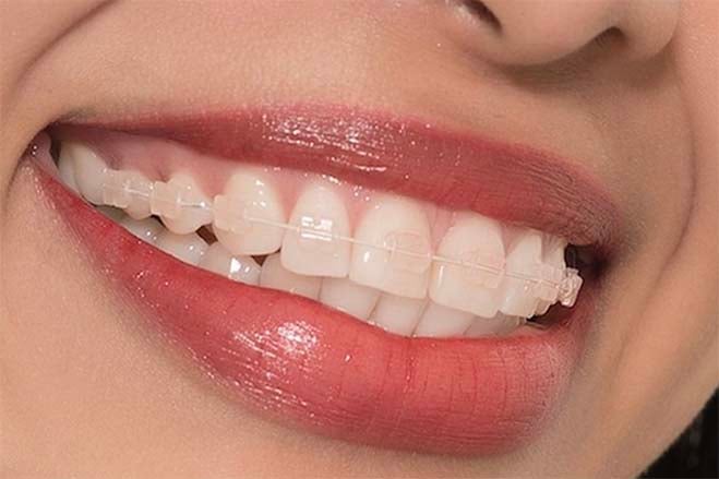 CFAST-dental-care-oral-health-woman-smiling-show-teeth-happy-lips-and confidence