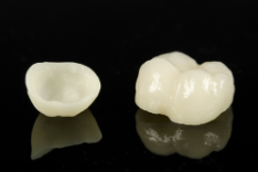 Ceramic Crowns