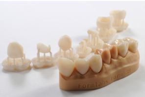 Composite Resin Crowns