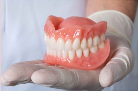 Copy-of-Dentures-Cost-in-Singapore-Budgeting-for-Your-Smile-Restoration