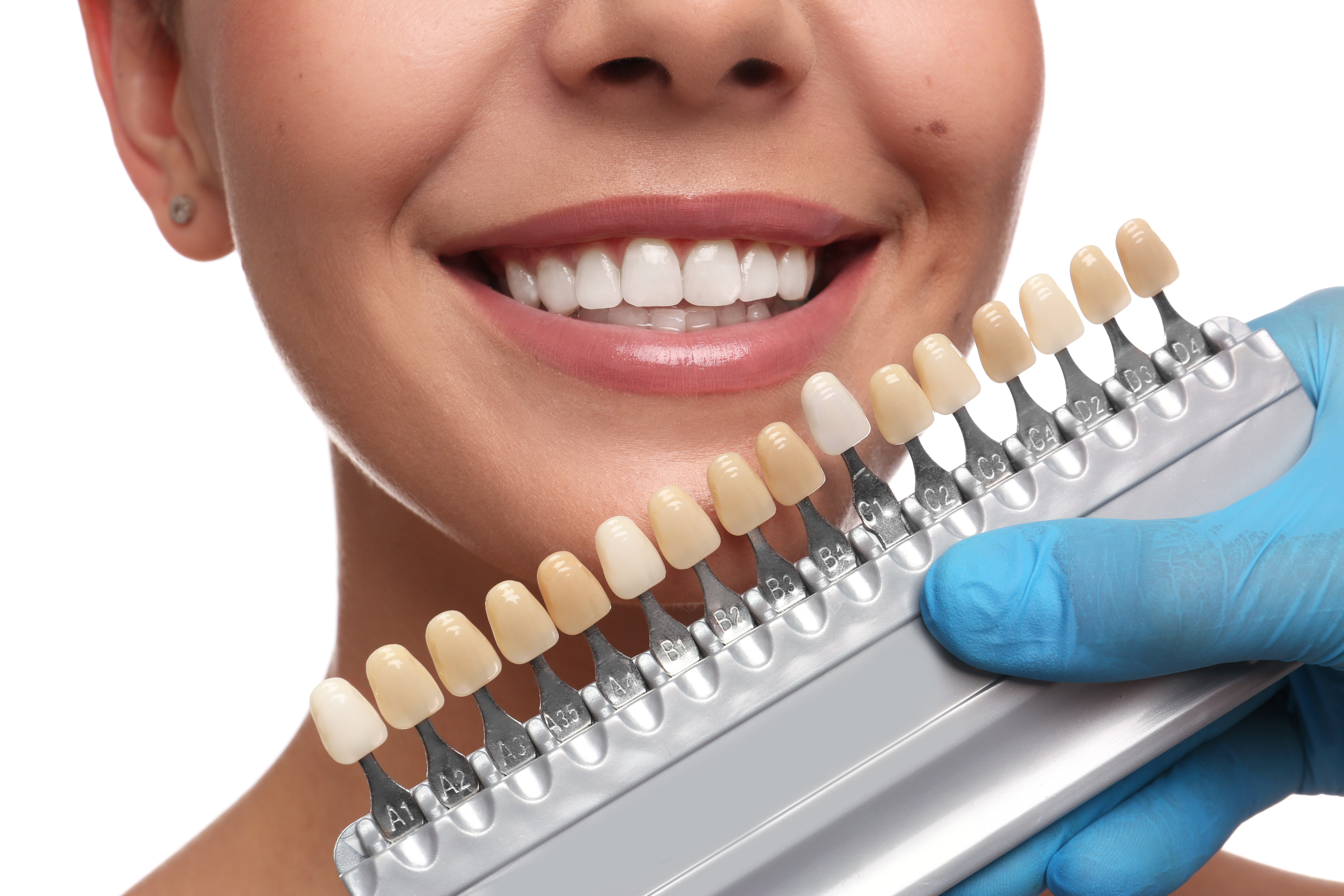 Doctor checking young womans teeth color on white background, closeup. Cosmetic dentistry