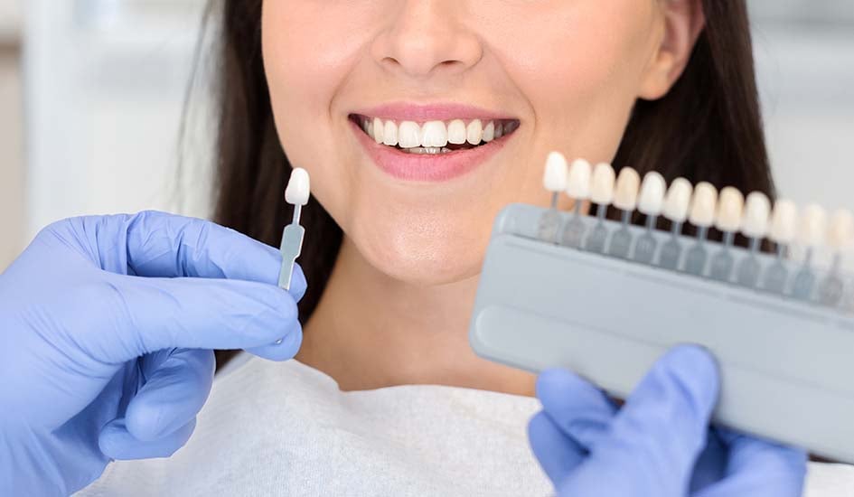 all-you-need-to-know-about-dental-veneers-dental-care-oral-health-woman-smile