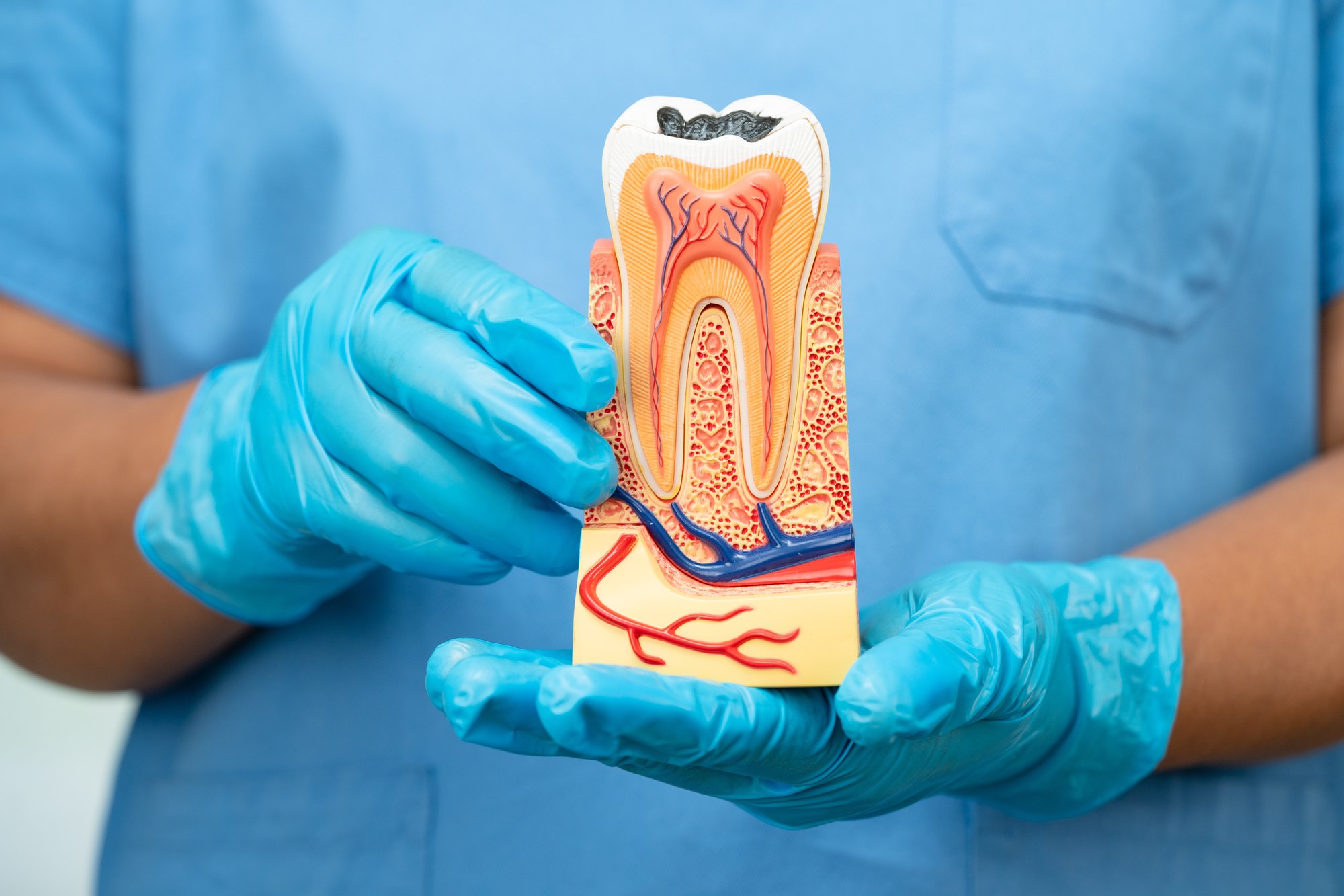 asian-dentist-holding-dental-implant-artificial-t-2024-08-08-21-05-23-utc