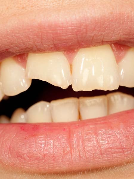 Emergency and Night Dentistry: Fixing Dental Problems Immediately
