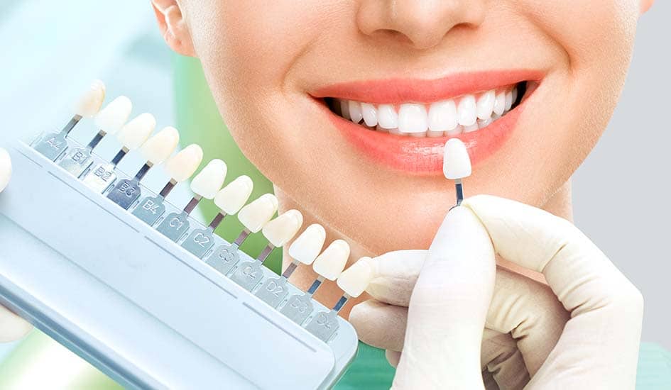 close-up-portrait-young-women-dentist-chair-check-select-color-teeth-dentist-makes-process-treatment-dental-clinic-office-teeth-whitening-2