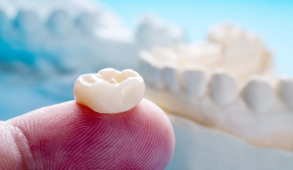dental-crowns-dental-care-oral-health