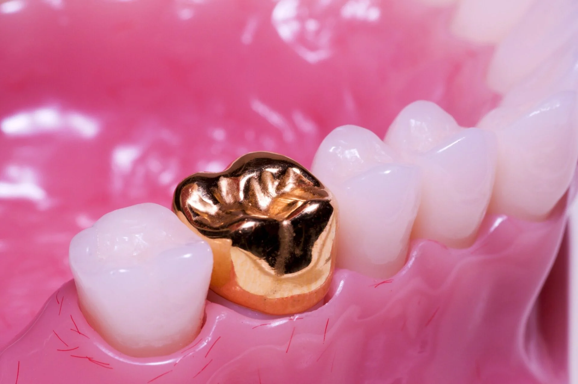 gold crown