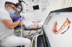intraoral-scanners
