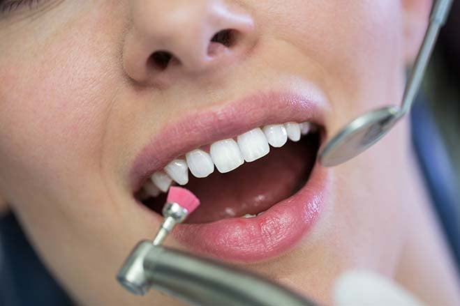 maintenance-dental-care-oral-health-check-up