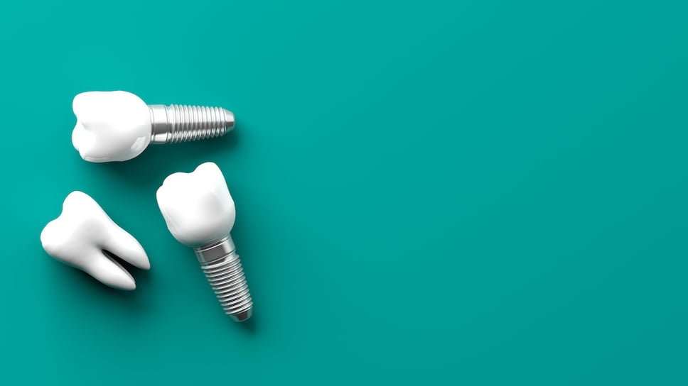metal dental implants