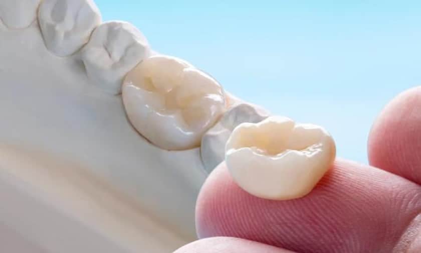 porcelain dental crown