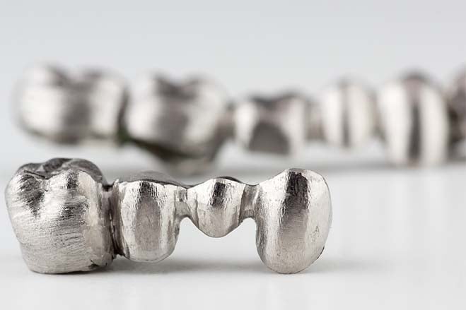 porcelain-fused-with-metal-crowns-smile-dental-care-oral-health