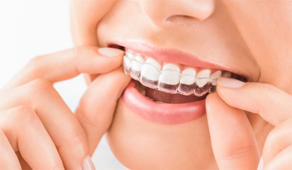 removable-invisalign-introducing-our-latest-expert-nuffield-dental-dentist-korean-caring-teeth