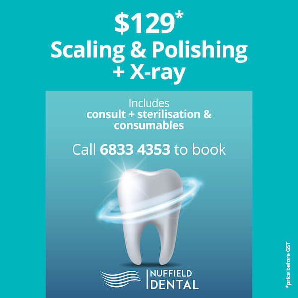 scaling and polishing + x-ray $129