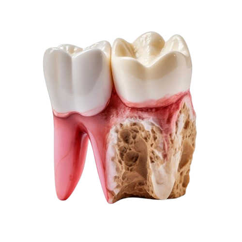 sore-tooth-amidst-healthy-teeth-isolated-transparent-background_191095-15836-removebg-preview