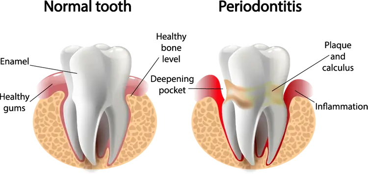 tooth-problem-750