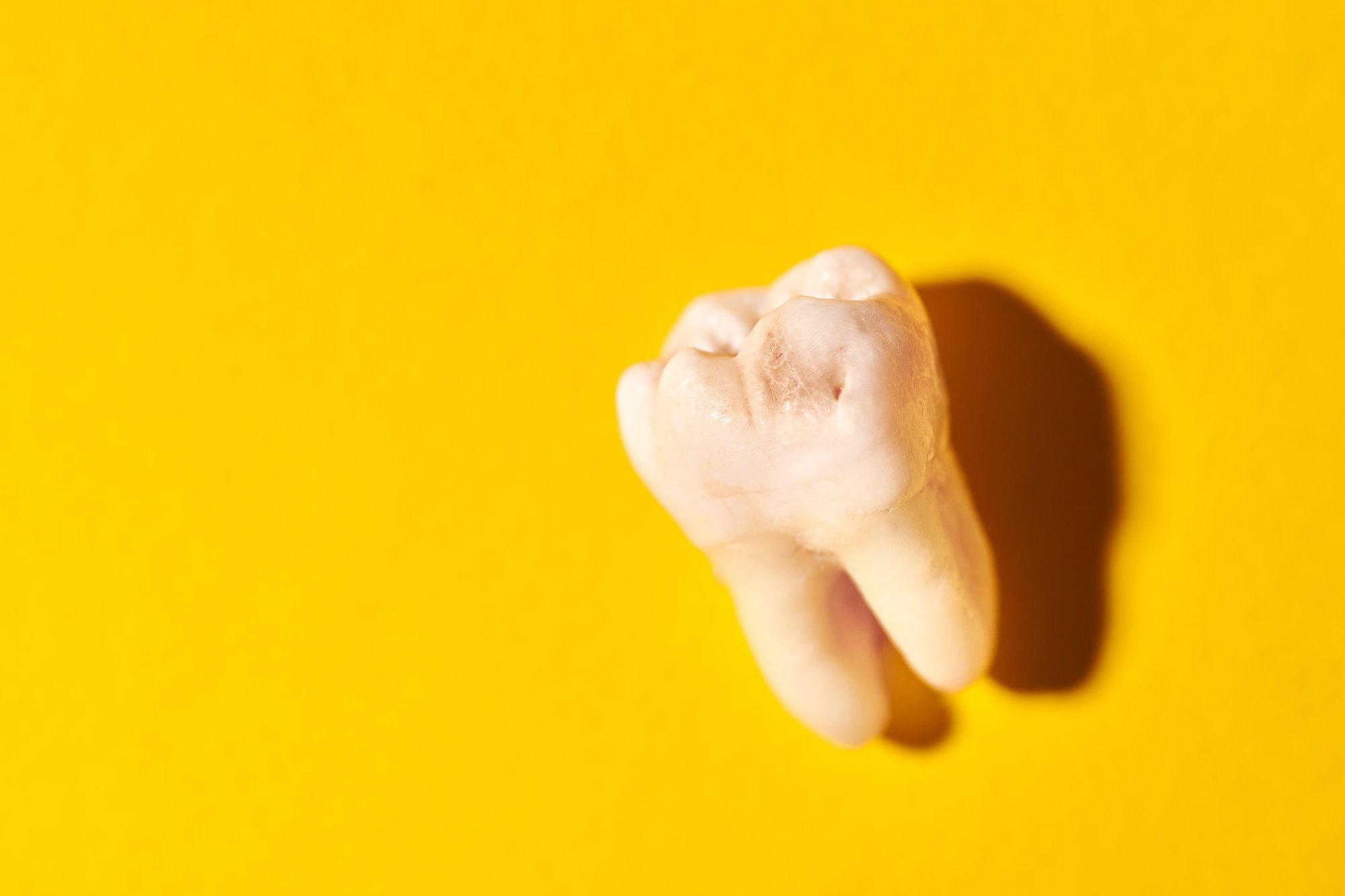 wisdom-tooth-with-tooth-decay-yellow-background-2024-07-23-19-29-53-utc