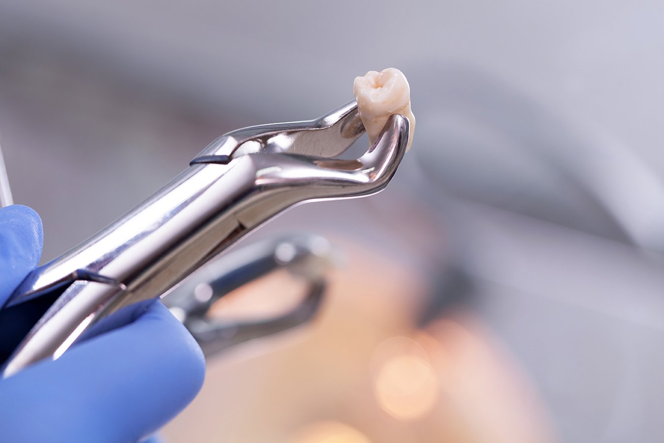 07 Wisdom tooth pain2