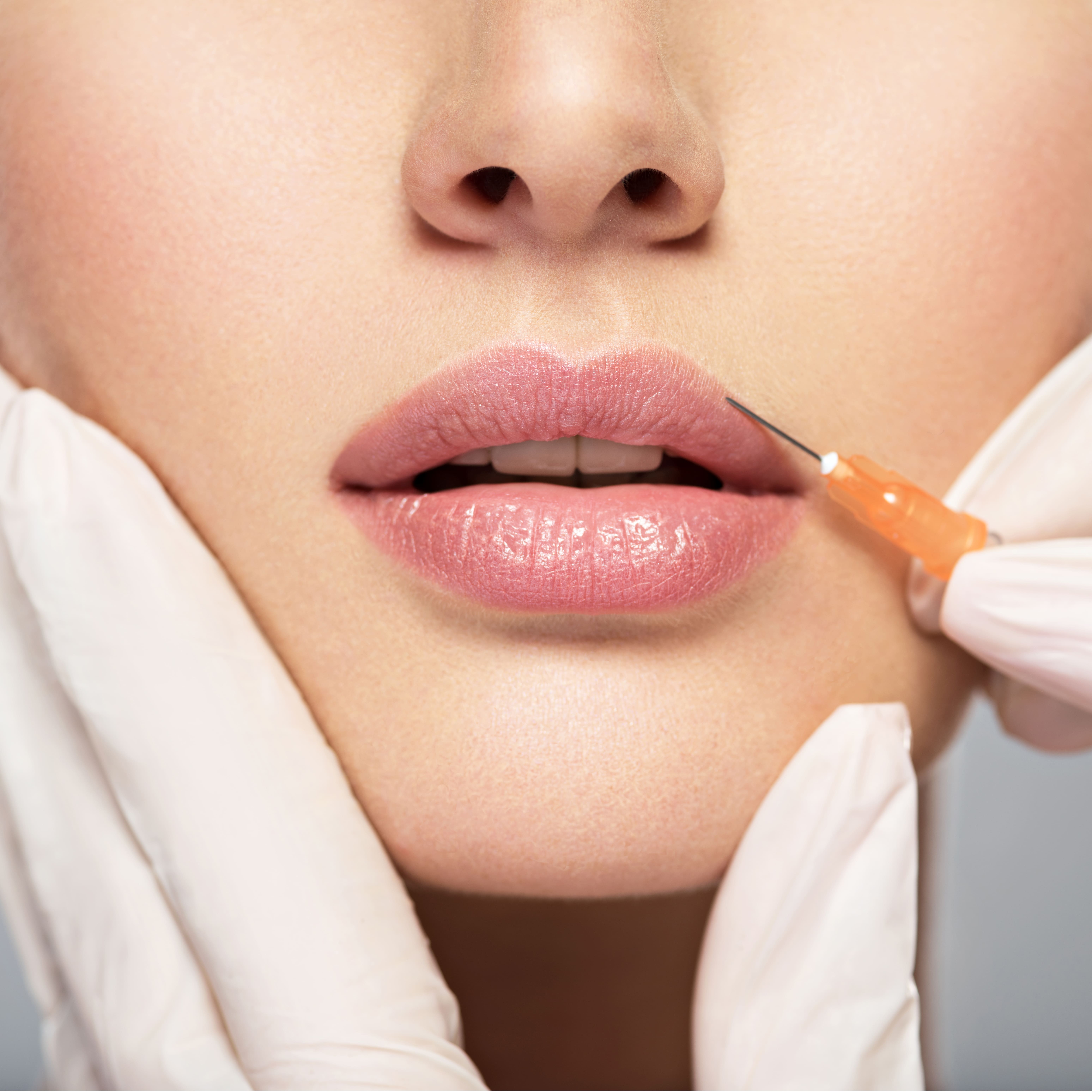 LipFiller_737351491-1