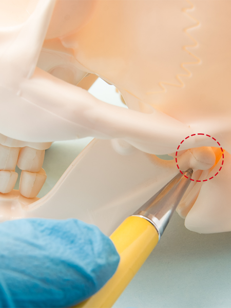 Overview of Jaw Joint Arthrocentesis