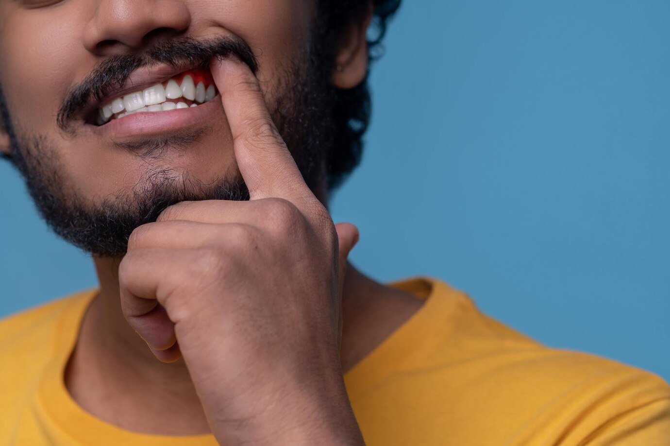 adult-man-showing-his-periodontal-disease-before-camera_259150-57666