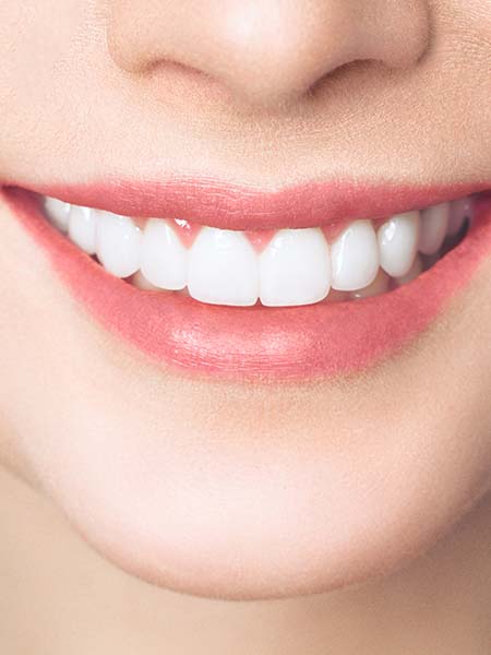 composite-bonding-smiling-girl-whitening-teeth-dental-care-oral-health