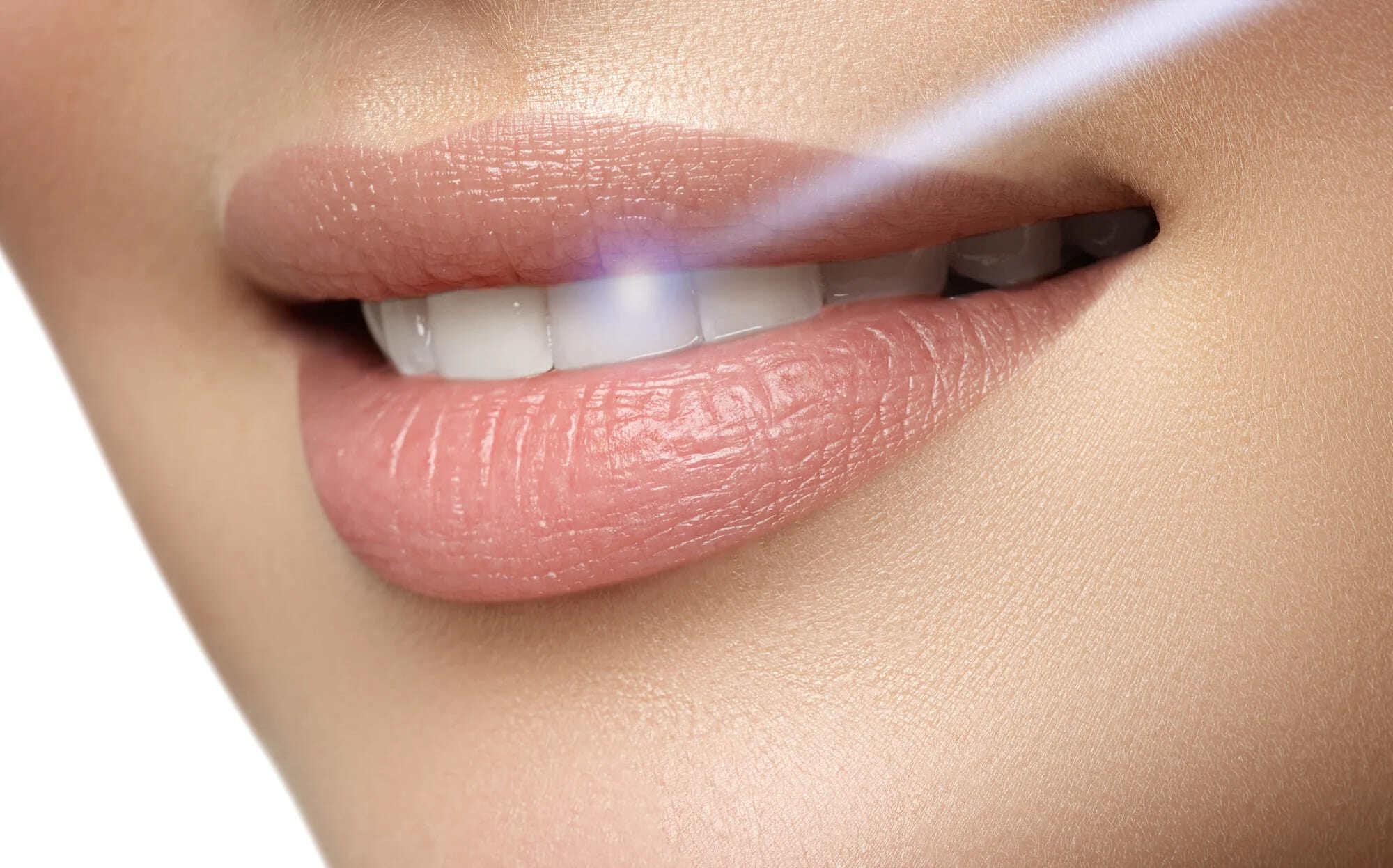 lanap treatment (1)