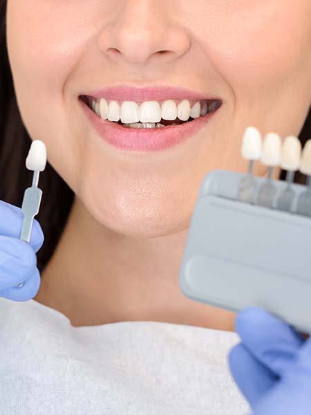 veneers-smile-dental-care-oral-health-asian-girl