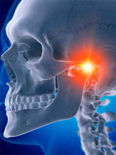 what-can-cause-jaw-joint-dysfunction-skull-dental-care-oral-health